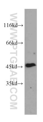 GDI2 Antibody in Western Blot (WB)