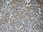 GDI2 Antibody in Immunohistochemistry (Paraffin) (IHC (P))
