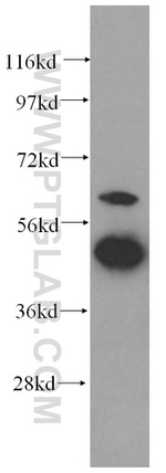GDI2 Antibody in Western Blot (WB)