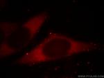 BORIS Antibody in Immunocytochemistry (ICC/IF)