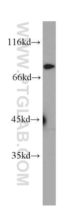 BORIS Antibody in Western Blot (WB)