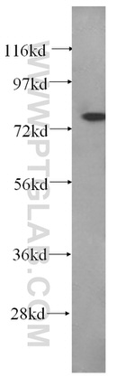 BORIS Antibody in Western Blot (WB)