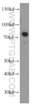 BORIS Antibody in Western Blot (WB)