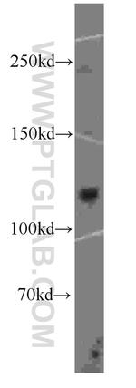 DGCR8 Antibody in Western Blot (WB)