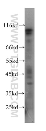 DGCR8 Antibody in Western Blot (WB)