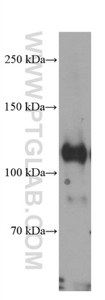 DGCR8 Antibody in Western Blot (WB)