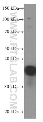 EEF1D Antibody in Western Blot (WB)