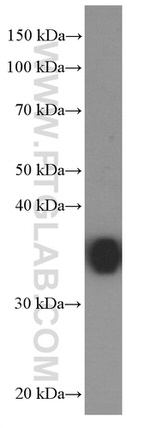 EEF1D Antibody in Western Blot (WB)