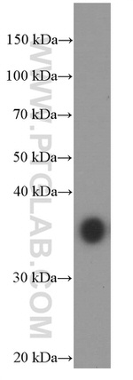 EEF1D Antibody in Western Blot (WB)