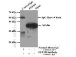 EEF1D Antibody in Immunoprecipitation (IP)