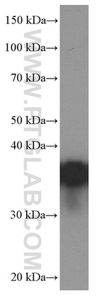 EEF1D Antibody in Western Blot (WB)