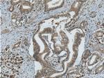 RISC Antibody in Immunohistochemistry (Paraffin) (IHC (P))