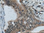 RISC Antibody in Immunohistochemistry (Paraffin) (IHC (P))
