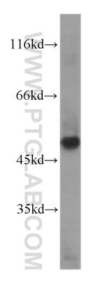 RISC Antibody in Western Blot (WB)