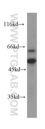 RISC Antibody in Western Blot (WB)