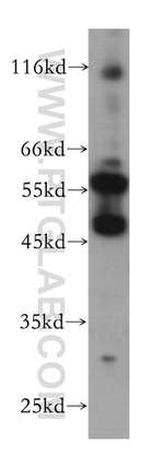 RISC Antibody in Western Blot (WB)