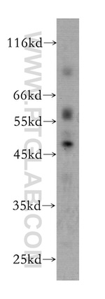 RISC Antibody in Western Blot (WB)