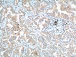 PFN2 Antibody in Immunohistochemistry (Paraffin) (IHC (P))