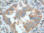 PFN2 Antibody in Immunohistochemistry (Paraffin) (IHC (P))