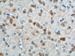 PFN2 Antibody in Immunohistochemistry (Paraffin) (IHC (P))
