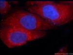 ITM2C Antibody in Immunocytochemistry (ICC/IF)