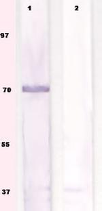 Phospho-S6K (Ser434) Antibody in Western Blot (WB)