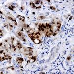 IKK-alpha Antibody in Immunohistochemistry (Paraffin) (IHC (P))