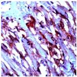 CD117/Kit/c-Kit Antibody in Immunohistochemistry (Paraffin) (IHC (P))