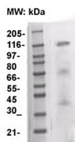 CD117/Kit/c-Kit Antibody in Western Blot (WB)