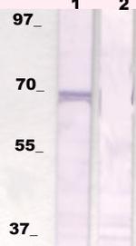 p70S6K Antibody in Western Blot (WB)