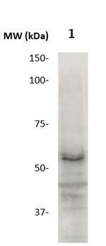 MMP-17 (MT4-MMP, MT-MMP-4) Antibody in Western Blot (WB)