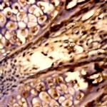 SOX-14 Antibody in Immunohistochemistry (Paraffin) (IHC (P))