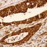 PDX-1 Antibody in Immunohistochemistry (Paraffin) (IHC (P))