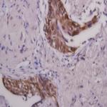 Phospho-IRS1 (Tyr612) Antibody in Immunohistochemistry (Paraffin) (IHC (P))