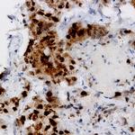 CDC25b Antibody in Immunohistochemistry (Paraffin) (IHC (P))