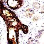 CDC25b Antibody in Immunohistochemistry (Paraffin) (IHC (P))