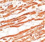 Troponin T Antibody in Immunohistochemistry (Paraffin) (IHC (P))