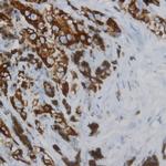 Phospho-CD136 (RON) (Tyr1238, Tyr1239) Antibody in Immunohistochemistry (Paraffin) (IHC (P))