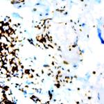 Phospho-CD136 (RON) (Tyr1238) Antibody in Immunohistochemistry (Paraffin) (IHC (P))