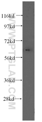 Fibromodulin Antibody in Western Blot (WB)