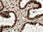 NR2F6 Antibody in Immunohistochemistry (Paraffin) (IHC (P))