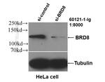 BRD8 Antibody in Western Blot (WB)