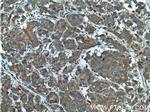 RABEP2 Antibody in Immunohistochemistry (Paraffin) (IHC (P))