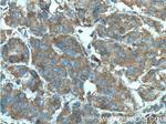 RABEP2 Antibody in Immunohistochemistry (Paraffin) (IHC (P))