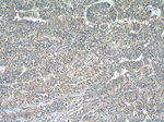 RABEP2 Antibody in Immunohistochemistry (Paraffin) (IHC (P))