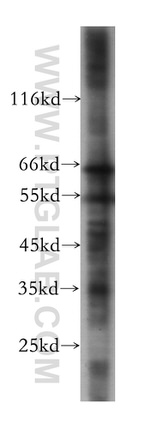 RABEP2 Antibody in Western Blot (WB)