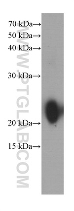 Gastrokine 1 Antibody in Western Blot (WB)