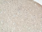 KCNIP4 Antibody in Immunohistochemistry (Paraffin) (IHC (P))