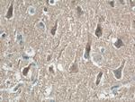 KCNIP4 Antibody in Immunohistochemistry (Paraffin) (IHC (P))