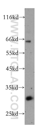 KCNIP4 Antibody in Western Blot (WB)
